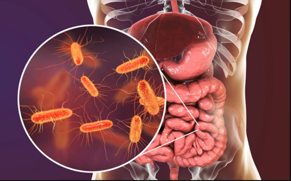 Listeriosis: la infección silenciosa que puede tener graves consecuencias para la salud